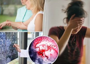 Strokes are common — here’s how to prevent most of them