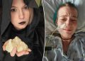 I have the same rare ‘vampire’ condition Count Dracula had — garlic can kill me